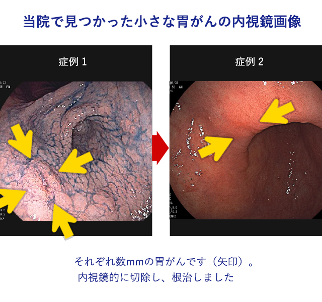 内視鏡検査