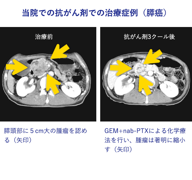 抗がん剤・生物学的製剤