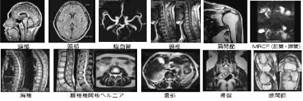 MRI撮影のご案内